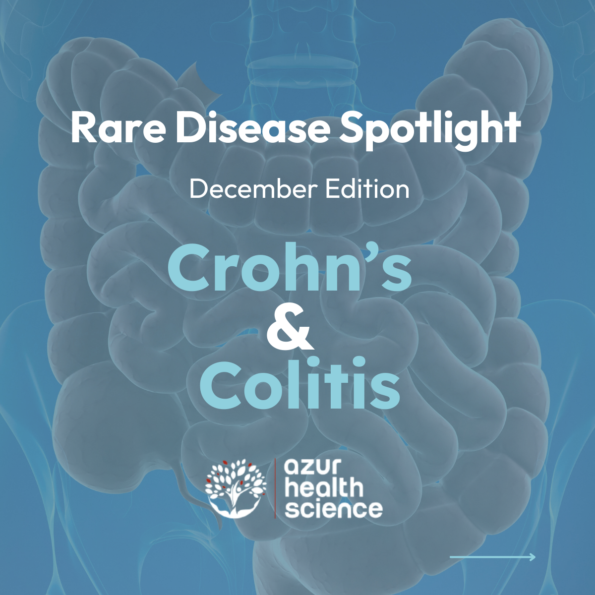 Rare disease Spotlight Crohn's and Colitis