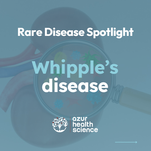 Rare disease Whipple's disease