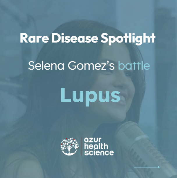 Lupus rare disease